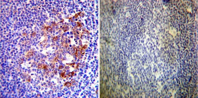 IHC-P analysis of human tonsil tissue using GTX22928 Hsp90 alpha antibody. Left : Primary antibody Right : Negative control without primary antibody Antigen retrieval : heat induced antigen retrieval was performed using 10mM sodium citrate (pH6.0) buffer, microwaved for 8-15 minutes Dilution : 1:200
