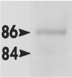 WB analysis of Hsp86 (Hsp90 alpha) and Hsp84 (Hsp90 beta) using GTX22928 Hsp90 alpha antibody. (left) or GTX79247 HSP90 beta antibody respectively