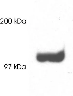 WB analysis of rat brain extract using GTX22930 PSD93 antibody.