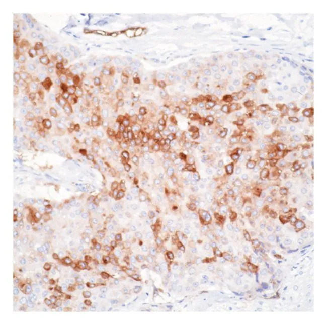 IHC-P analysis of tissue using GTX23099 RPSA antibody [MLuC5].