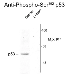 Western blot of rat brain nuclear fraction lysate showing specific immunolabeling of the ~53k using p53 (phospho Ser392) antibody (GTX23257) p53 phosphorylated at Ser392 (Control). The phosphospecificity of this labeling is shown in the second lane (lambda-phosphatase: lambda-Ptase). The blot is identical to the control except that it was incubated in lambda-Ptase (1200 units for 30 min) before being exposed to the phospho Ser392 p53 antibody. The immunolabeling is completely eliminated by treatment with lambda-Ptase. Western blot of rat brain nuclear fraction lysate showing specific immunolabeling of the ~53k using p53 (phospho Ser392) antibody (GTX23257) p53 phosphorylated at Ser392 (Control). The phosphospecificity of this labeling is shown in the second lane (lambda-phosphatase: lambda-Ptase). The blot is identical to the control except that it was incubated in lambda-Ptase (1200 units for 30 min) before being exposed to the phospho Ser392 p53 antibody. The immunolabeling is completely eliminated by treatment with lambda-Ptase.