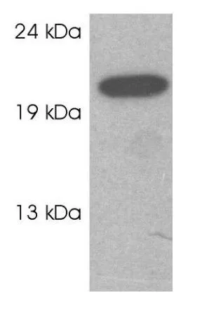 WB analysis of AtT20 cell lysate using GTX23336 RAB3C antibody.