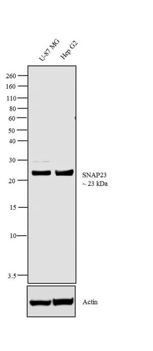 WB analysis of membrane enriched extracts (30 microg lysate) of U-87 MG (Lane 1) and Hep G2 (Lane 2) using GTX23340 SNAP23 antibody. Dilution : 2 microg/ml