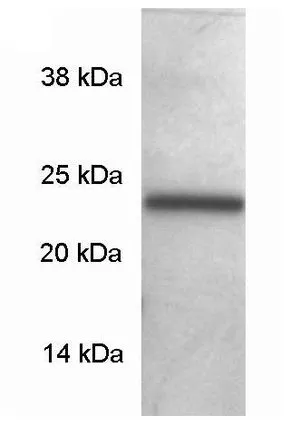 WB analysis of rat brain protein extract using GTX23340 SNAP23 antibody.