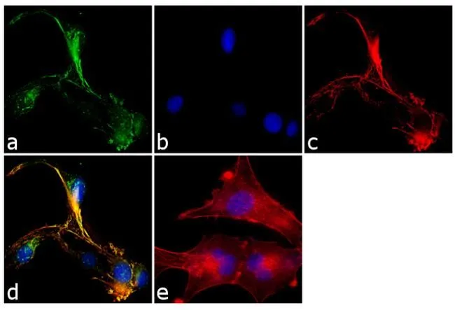 WB analysis of rat brain protein extract using GTX23340 SNAP23 antibody.