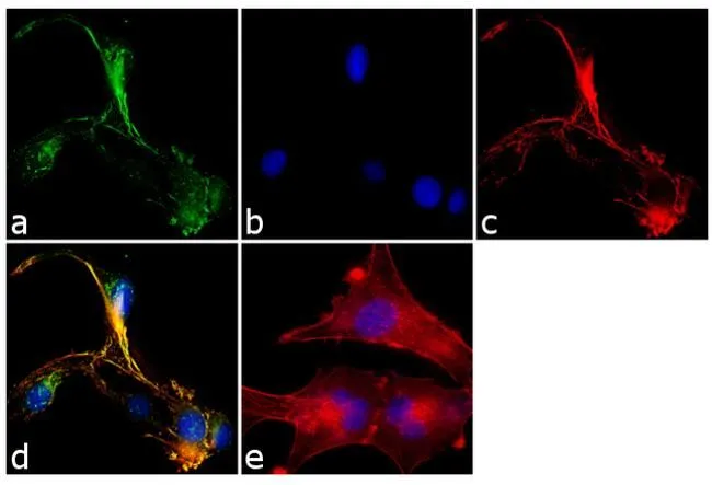 ICC/IF analysis of U-87 MG cells using GTX23340 SNAP23 antibody. Panel e is a no primary antibody control. Green : Primary antibody Blue : Nuclei Red : Actin Fixation : 4% paraformaldehyde Permeabilization : 0.1% Triton X-100 for 10 minute Dilution : 2 microg/ml in 0.1% BSA incubated for 3 hours at room temperature