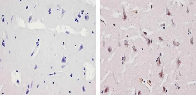 IHC-P analysis of human brain tissue using GTX23341 Ubiquilin 1 antibody. Right : Primary antibody Left : Negative control without primary antibody Antigen retrieval : 10mM sodium citrate (pH 6.0),microwaved for 8-15 min Dilution : 1:100