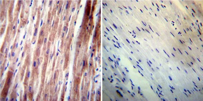 IHC-P analysis of human heart tissue using GTX23348 VAMP4 antibody. Left : Primary antibody Right : Negative control without primary antibody Antigen retrieval : heat induced antigen retrieval was performed using 10mM sodium citrate (pH6.0) buffer, microwaved for 8-15 minutes Dilution : 1:200