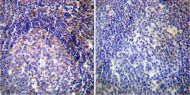 IHC-P analysis of human tonsil tissue using GTX23348 VAMP4 antibody. Left : Primary antibody Right : Negative control without primary antibody Antigen retrieval : heat induced antigen retrieval was performed using 10mM sodium citrate (pH6.0) buffer, microwaved for 8-15 minutes Dilution : 1:200