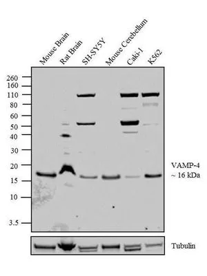 WB analysis of acid extracts (40 microg lysate) of Mouse Brain (Lane 1), Rat Brain (Lane 2), SH-SY5Y (Lane 3), Mouse Cerebellum (Lane 4), Caki-1 (Lane 5) and K562 (Lane 6) using GTX23348 VAMP4 antibody. Dilution : 0.5-3 microg/ml
