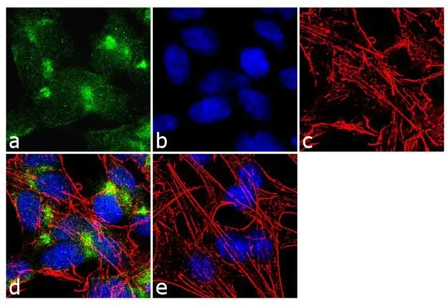 ICC/IF analysis of SH-SY5Y cells using GTX23348 VAMP4 antibody. Panel e is a no primary antibody control. Green : Primary antibody Blue : Nuclei Red : Actin Fixation : 4% paraformaldehyde Permeabilization : 0.1% Triton X-100 for 10 minute Dilution : 2 microg/ml in 0.1% BSA and incubated for 3 hours at room temperature