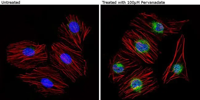 ICC/IF analysis of HUVEC cells treated with 100microM pervanadate (right) and untreated cells (left) using GTX23417 Caveolin 2 (phospho Tyr19) antibody. Green : Primary antibody Blue : Nuclei Red : Actin Fixation : Formalin Permeabilization : 0.1% Triton X-100 in TBS for 5-10 minute Dilution : 1:20 overnight at 4oC