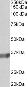 WB analysis of human (A), mouse (B) and rat (C) spleen lysate using GTX23426 BOB1 antibody. Dilution : 0.3microg/ml Loading : 35microg protein in RIPA buffer