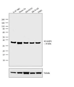 WB analysis of membrane extracts (30 microglysate) of U-87 MG (Lane 1), Neuro-2a (Lane 2), SH-SY5Y (Lane 3), SK-N-AS (Lane 4), and T98G (Lane 5) using GTX23431 SCAMP2 antibody. Dilution : 2 microg/ml