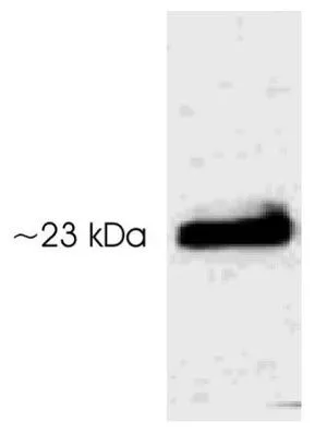 WB analysis of transfected 293T cell lysate using GTX23439 Serotonin N-AT (phospho Thr29) antibody. WB analysis of transfected 293T cell lysate using GTX23439 Serotonin N-AT (phospho Thr29) antibody.