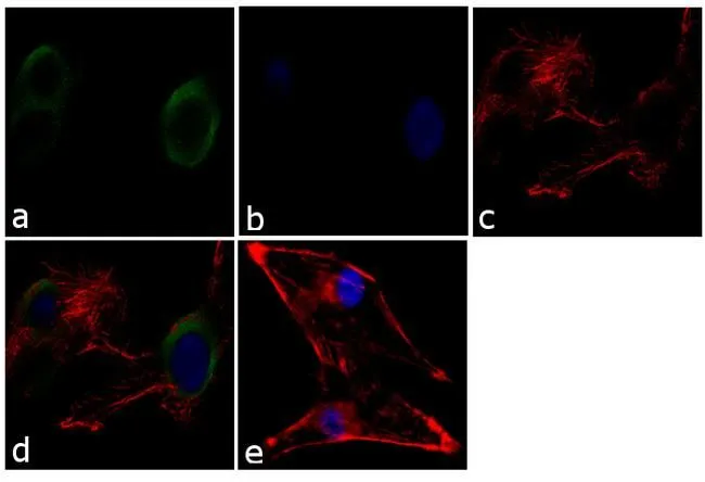 ICC/IF analysis of U-87 MG cells using GTX23451 Munc18 antibody. Panel e is a no primary antibody control. Green : Primary antibody Blue : Nuclei Red : Actin Fixation : 4% paraformaldehyde Permeabilization : 0.1% Triton X-100 for 10 minute Dilution : 2 microg/ml in 0.1% BSA incubated for 3 hours at room temperature