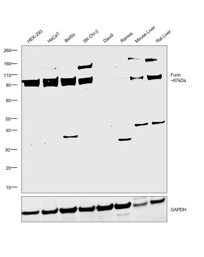 WB analysis of various sample lysates using GTX23467 Furin antibody. Expression of Furin was observed in HEK-293, HaCaT, BeWo, SK-O-V3, Mouse Liver and Rat Liver but not in Daudi and Ramos which are known to be low expressing cell lines (DOI: 10.1099/0022-1317-75-10-2821). Dilution : 1:1000 Loading : 30microg