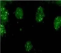 ICC/IF analysis of rabbit granule cells using GTX23474 CSEN antibody.