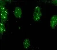ICC/IF analysis of rabbit granule cells using GTX23474 CSEN antibody. ICC/IF analysis of rabbit granule cells using GTX23474 CSEN antibody.
