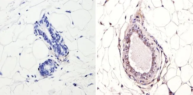 IHC-P analysis of mouse breast tissue using GTX23482 NCOR1 antibody. Right : Primary antibody Left : Negative control without primary antibody Antigen retrieval : 10mM sodium citrate (pH 6.0), microwaved for 8-15 min Dilution : 1:200