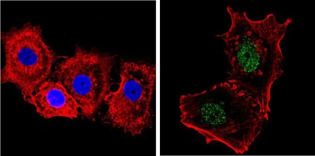 ICC/IF analysis of MCF-7 cells using GTX23482 NCOR1 antibody. Cells were probed without (left) or with(right) an antibody. Green : Primary antibody Blue : Nuclei Red : Actin Fixation : Formalin Permeabilization : 0.1% Triton X-100 in TBS for 5-10 minute Dilution : 1:200 incubated overnight at 4 oC