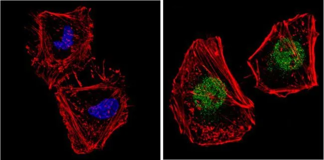 ICC/IF analysis of HeLa cells using GTX23482 NCOR1 antibody. Cells were probed without (left) or with(right) an antibody. Green : Primary antibody Blue : Nuclei Red : Actin Fixation : Formalin Permeabilization : 0.1% Triton X-100 in TBS for 5-10 minute Dilution : 1:200 incubated overnight at 4 oC