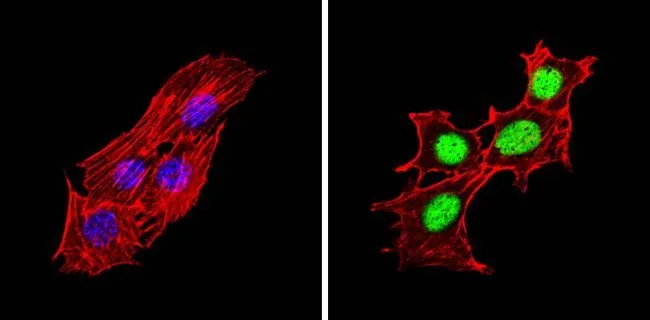 ICC/IF analysis of C2C12 cells using GTX23484 PPAR alpha (phospho Ser12) antibody. Cells were probed without (left) or with(right) an antibody. Green : Primary antibody Blue : Nuclei Red : Actin Fixation : Formalin Permeabilization : 0.1% Triton X-100 in TBS for 5-10 minute Dilution : 1:200 incubated overnight at 4 oC