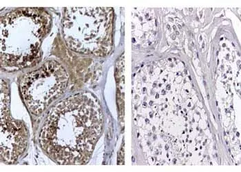 Immunohistochemistry Rabbit Anti-Human DNMT3L Antibody 1:500 Immunohistochemistry Rabbit Anti-Human DNMT3L Antibody 1:500