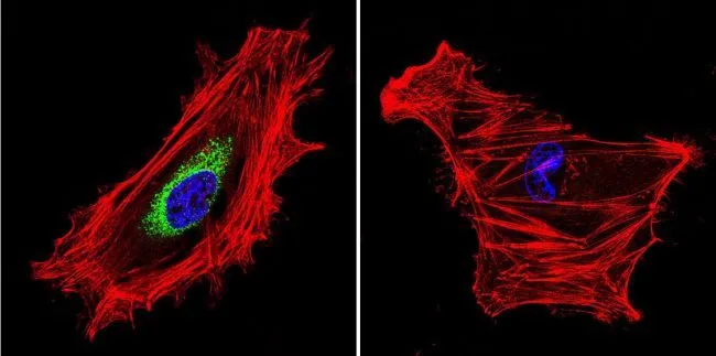 ICC/IF analysis of HeLa cells using GTX23514 Calpain S1 antibody [156]. Cells were probed without (right) or with(left) an antibody. Green : Primary antibody Blue : Nuclei Red : Actin Fixation : formaldehyde Dilution : 1:20 overnight at 4oC