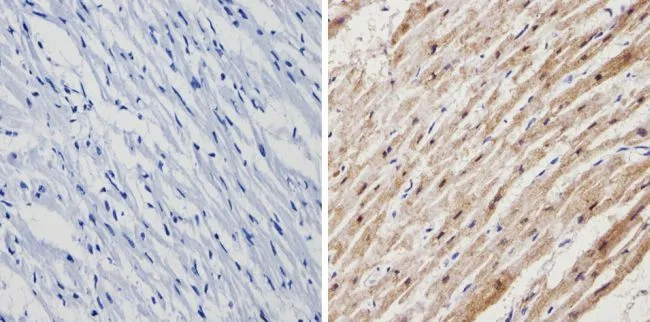 IHC-P analysis of human heart tissue using GTX23516 Calsequestrin antibody. Right : Primary antibody Left : Negative control without primary antibody Antigen retrieval : 10mM sodium citrate (pH 6.0) microwaved for 8-15 min Dilution : 1:200