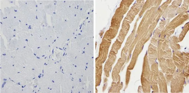 IHC-P analysis of human skeletal muscle using GTX23516 Calsequestrin antibody. Right : Primary antibody Left : Negative control without primary antibody Antigen retrieval : 10mM sodium citrate (pH 6.0) microwaved for 8-15 min Dilution : 1:200