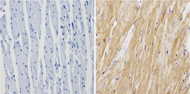 IHC-P analysis of mouse heart tissue using GTX23516 Calsequestrin antibody. Right : Primary antibody Left : Negative control without primary antibody Antigen retrieval : 10mM sodium citrate (pH 6.0) microwaved for 8-15 min Dilution : 1:200