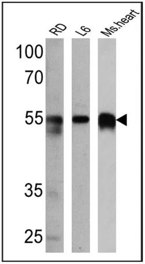 WB analysis of 25 ug of RD (Lane 1), L6 (Lane 2) and mouse heart (Lane 3) cell lysates using GTX23516 Calsequestrin antibody. Dilution : 1:5000