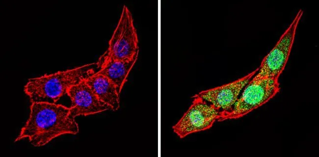 ICC/IF analysis of C2C12 cells using GTX23516 Calsequestrin antibody. Cells were probed without (left) or with(right) an antibody. Green : Primary antibody Blue : Nuclei Red : Actin Fixation : Formalin Permeabilization : 0.1% Triton X-100 in TBS for 5-10 minute Dilution : 1:100 incubated overnight at 4 oC