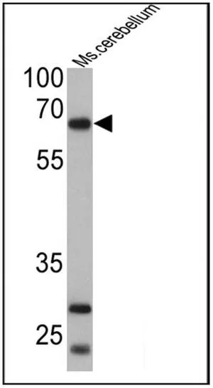 WB analysis of 25 ug of mouse cerebellum cell lysates using GTX23533 PC2 antibody. Dilution : 1:500