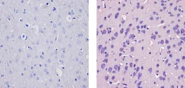 IHC-P analysis of rat brain tissue using GTX23557 CaMKIV antibody. Right : Primary antibody Left : Negative control without primary antibody Antigen retrieval : 10mM sodium citrate (pH 6.0),microwaved for 8-15 min Dilution : 1:20