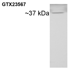 Western blot of CyPD on rat brain extract using GTX23567.