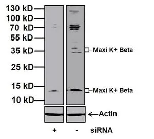 WB analysis of MOVAS whole cell lysates with and without Maxi K+ Beta (KCNMB1) siRNA using GTX23587 KCNMB1 antibody. Dilution : 1 microg/ml Loading : 20 microg