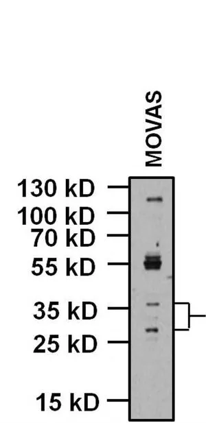 WB analysis of 20 ug of Movas whole cell lysates using GTX23587 KCNMB1 antibody. Dilution : 1 microg/ml
