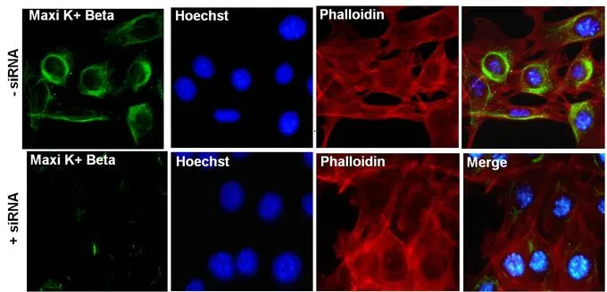 ICC/IF analysis of MOVAS cells transfected with (+) and without (-) Maxi K+ Beta (KCNMB1) siRNA using GTX23587 KCNMB1 antibody. Green : Primary antibody Blue : Nuclei Red : Actin Fixation : 4% paraformaldehyde Permeabilization : 0.1% Triton X-100 in PBS for 10 minutes Dilution : 1:100 in staining buffer for 1 hour at room temperature