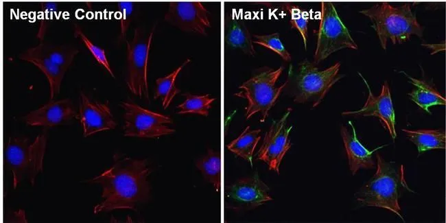 ICC/IF analysis of Movas cells using GTX23587 KCNMB1 antibody. Cells were probed without (left) or with(right) an antibody. Green : Primary antibody Blue : Nuclei Red : Actin Fixation : 4% paraformaldehyde Permeabilization : 0.1% Triton X-100 in PBS for 10 minutes Dilution : 1:100 in staining buffer for 1 hour at room temperature