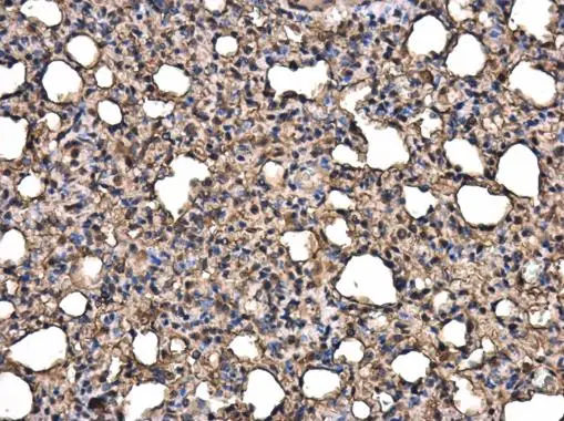 RAGE antibody detects RAGE protein in rat lung by immunohistochemical analysis. Sample: Paraffin-embedded rat lung. RAGE antibody (GTX23611) diluted at 1:400. Antigen Retrieval: Citrate buffer, pH 6.0, 15 min