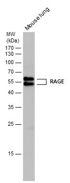 Mouse tissue extract (50 microg) was separated by 12% SDS-PAGE, and the membrane was blotted with RAGE antibody (GTX23611) diluted at 1:5000. The HRP-conjugated anti-rabbit IgG antibody (GTX213110-01) was used to detect the primary antibody.