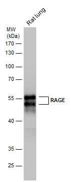 Rat tissue extract (50 microg) was separated by 10% SDS-PAGE, and the membrane was blotted with RAGE antibody (GTX23611) diluted at 1:5000. The HRP-conjugated anti-rabbit IgG antibody (GTX213110-01) was used to detect the primary antibody.