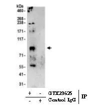 IP analysis of 293T cell lysate using GTX23625 SERCA2 ATPase antibody. IP protein : 0.5 -1.0 mg Dilution : 1 ug/ml for WB ; 0.5-1 mg lysate / 6ug antibody for IP reaction Loading: 20% of IP loaded