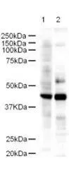 Western blot using GeneTex's Affinity Purified anti-LDB2 antibody shows detection of a 43-kDa band corresponding to LDB2 in a lysates prepared from human kidney and mouse spleen tissues.