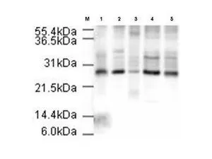 Affinity Purified Rabbit anti-APC10 (GTX23629) was used at a 1:500 dilution to detect human APC10 in various cell extracts. This antibody clearly detects a ~26 kDa band corresponding to human APC10 (predicted molecular weight is 21 kDa). All lanes contain 20 ug of lysate or extract as follows: lane 1, HeLa nuclear extract; lane 2, HeLa whole cell lysate; lane 3, A431 whole cell lysate; lane 4, Jurkat whole cell lysate; lane 5, 293 whole cell lysate. Primary antibody was reacted with the membrane at room temperature for 1 h. After subsequent washing, a 1:5,000 dilution of HRP conjugated Gt-a-Rabbit IgG was used for visualization. Exposure time was 4 min.