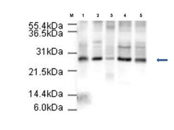 WB analysis of various samples using GTX23629 Apc10 antibody. Lane 1 : HeLa cell nuclear extract Lane 2 : HeLa whole cell lysate Lane 3 : A431 whole cell lysate Lane 4 : Jurkat whole cell lysate Lane 5 : 293T whole cell lysate Loading : 20 microg Dilution : 1:500
