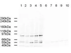 Western blot using GeneTex's Affinity Purified anti-AP2A antibody shows detection of a band just below 100 kDa correspond-ing to Human AP2A1 in a various preparations.
