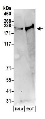 WB analysis of HeLa and 293T cell lysate prepared by NETN lysis buffer using GTX23719 Claspin antibody. Dilution : 0.2 microg/ml